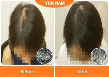 Yun-Nam-Hair-Care-Special-Promo-350x247 - Beauty & Health Hair Care Johor Kedah Kelantan Kuala Lumpur Melaka Negeri Sembilan Online Store Pahang Penang Perak Perlis Promotions & Freebies Putrajaya Sabah Sarawak Selangor Terengganu 