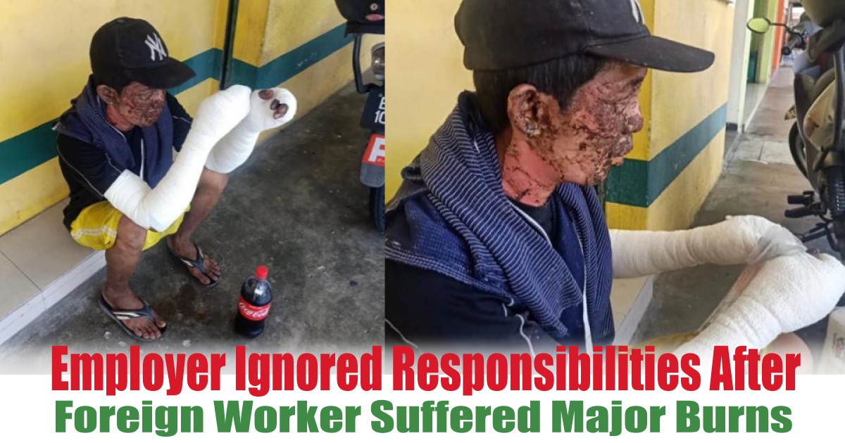 Worker-Suffered-Major-Burns-In-Factory-Accident - News 
