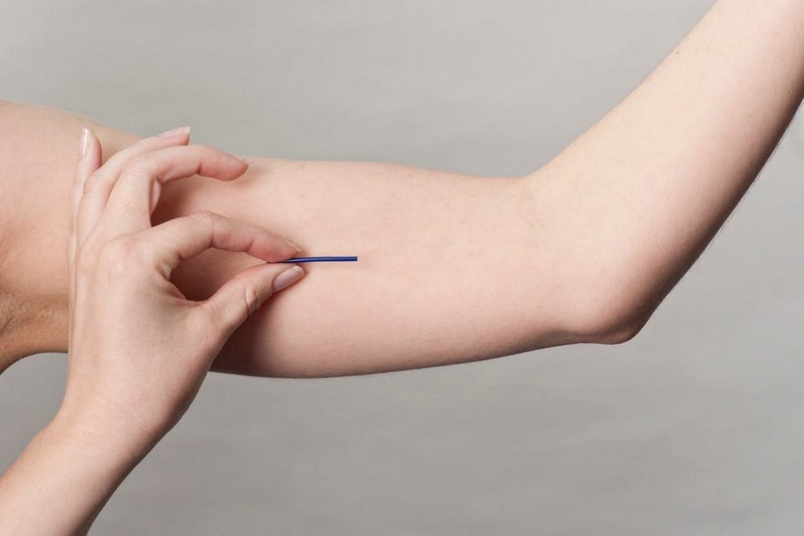 Guides on Type of Birth Control Available in Malaysia and What is the